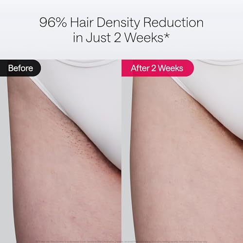 2026 Ulike Laser Hair Removal Device Air 10 Ipl Gift for Women and Men, Ice Cool and Permanent Hair Reduction for Nearly Painless, Dual Lights, Skin Sensor & USHR Mode Hair Removal in 10mins from Home
